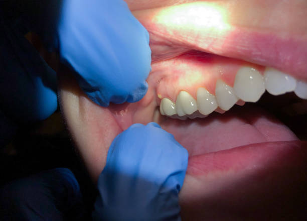 Best Teeth Whitening  in South Amherst, OH