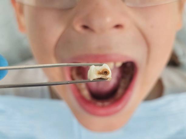 Best Emergency Pediatric Dentist  in South Amherst, OH