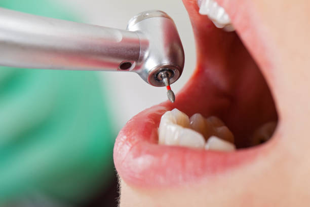 Best Root Canal Emergency Dentist  in South Amherst, OH